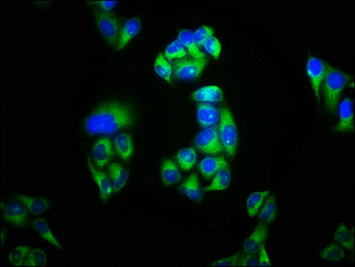 Immunofluorescence staining of Hela cells with KCNK3 Antibody at 1:100, counter-stained with DAPI. The cells were fixed in 4% formaldehyde, permeabilized using 0.2% Triton X-100 and blocked in 10% normal Goat Serum. The cells were then incubated with the antibody overnight at 4°C. The secondary antibody was Alexa Fluor 488-congugated AffiniPure Goat Anti-Rabbit IgG(H+L).