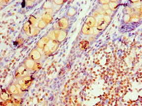 Immunohistochemistry of paraffin-embedded human colon tissue using the antibody at dilution of 1:100