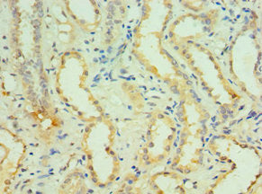 Immunohistochemistry of paraffin-embedded human kidney tissue using KCNN4 Antibody at dilution of 1:100