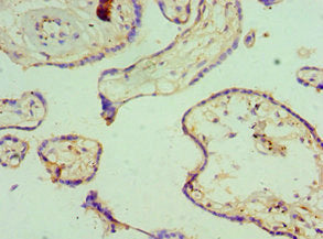 Immunohistochemistry of paraffin-embedded human placenta tissue using KCNN4 Antibody at dilution of 1:100