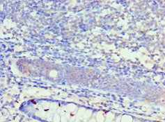Immunohistochemistry of paraffin-embedded human colon tissue using KCNN4 Antibody at dilution of 1:100