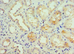 Immunohistochemistry of paraffin-embedded human kidney tissue using KCNN4 Antibody at dilution of 1:100
