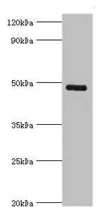 Western blot  | All lanes: KCNN4 antibody at 8µg/ml + human serum  | Secondary  | Goat polyclonal to rabbit IgG at 1/10000 dilution  | Predicted band size: 48 kDa  | Observed band size: 48 kDa
