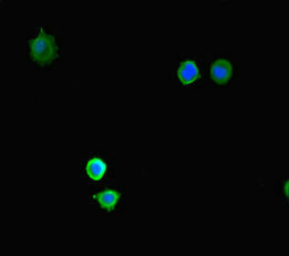 Immunofluorescent analysis of MCF-7 cells using KDM4A Antibody at dilution of 1:100 and Alexa Fluor 488-congugated AffiniPure Goat Anti-Rabbit IgG(H+L)
