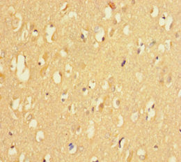 Immunohistochemistry of paraffin-embedded human brain tissue using KDM4A Antibody at dilution of 1:100