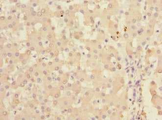 Immunohistochemistry of paraffin-embedded human liver tissue using KHK Antibody at dilution of 1:100