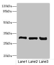 Western blot | All lanes: KHKantibody at 3.6μg/ml | Lane 1: Mouse liver tissue | Lane 2: Mouse kidney tissue | Lane 3: Rat kidney tissue | Secondary | Goat polyclonal to rabbit IgG at 1/10000 dilution | Predicted band size: 33 kDa | Observed band size: 33 kDa