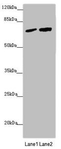 Western blot  | All lanes: KIAA0391 antibody at 1.06µg/ml  | Lane 1: LO2 whole cell lysate  | Lane 2: 293T whole cell lysate  | Secondary  | Goat polyclonal to rabbit IgG at 1/10000 dilution  | Predicted band size: 68, 66, 25, 57 kDa  | Observed band size: 68 kDa
