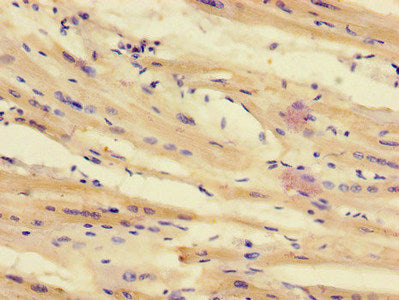 Immunohistochemistry of paraffin-embedded human heart tissue using the antibody at dilution of 1:100Rabbit anti-Human TTI1 Polyclonal Antibody
