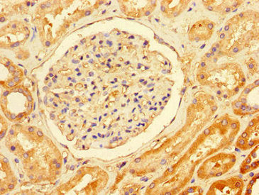 Immunohistochemistry of paraffin-embedded human kidney tissue using TTI1 Antibody at dilution of 1:100Rabbit anti-Human TTI1 Polyclonal Antibody