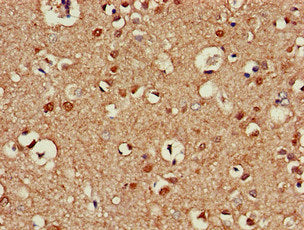 Immunohistochemistry of paraffin-embedded human brain tissue using ATG13 Antibody at dilution of 1:100Rabbit anti-Human ATG13 Polyclonal Antibody