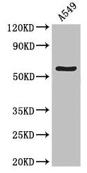 Western Blot  | Positive WB detected in: A549 whole cell lysate  | All lanes: ATG13 antibody at 4µg/ml  | Secondary  | Goat polyclonal to rabbit IgG at 1/50000 dilution  | Predicted band size: 57, 53, 45, 61 kDa  | Observed band size: 57 kDaRabbit anti-Human ATG13 Polyclonal Antibody