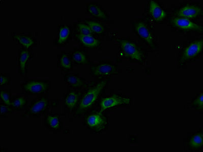 Immunofluorescent analysis of Hela cells using FAM234B Antibody at dilution of 1:100 and Alexa Fluor 488-congugated AffiniPure Goat Anti-Rabbit IgG(H+L)Rabbit anti-Human FAM234B Polyclonal Antibody