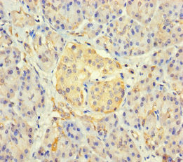 Immunohistochemistry of paraffin-embedded human pancreatic tissue using FAM234B Antibody at dilution of 1:100Rabbit anti-Human FAM234B Polyclonal Antibody