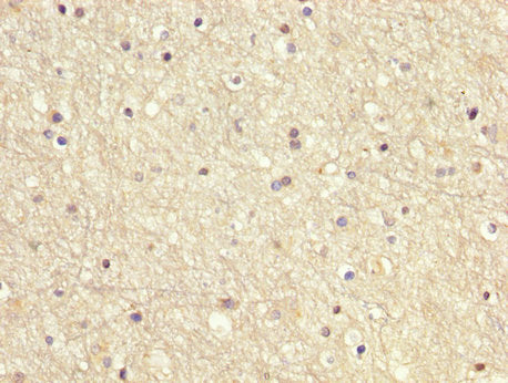 IHC image of GDI1 Antibody diluted at 1:200 and staining in paraffin-embedded human brain tissue performed on a Leica BondTM system. After dewaxing and hydration, antigen retrieval was mediated by high pressure in a citrate buffer (pH 6.0). Section was blocked with 10% normal goat serum 30min at RT. Then primary antibody (1% BSA) was incubated at 4°C overnight. The primary is detected by a biotinylated secondary antibody and visualized using an HRP conjugated SP system.Rabbit anti-Human GDI1 Polyclonal Antibody