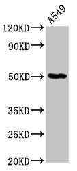 Western Blot  | Positive WB detected in: A549 whole cell lysate  | All lanes: GDI1 antibody at 6µg/ml  | Secondary  | Goat polyclonal to rabbit IgG at 1/50000 dilution  | Predicted band size: 51 kDa  | Observed band size: 51 kDaRabbit anti-Human GDI1 Polyclonal Antibody