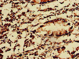 Immunohistochemistry of paraffin-embedded human appendix tissue using KIDINS220 Antibody at dilution of 1:100