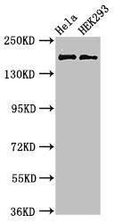 Western Blot  | Positive WB detected in: Hela whole cell lysate, HEK293 whole cell lysate  | All lanes: KIDINS220 antibody at 3µg/ml  | Secondary  | Goat polyclonal to rabbit IgG at 1/50000 dilution  | Predicted band size: 197, 186, 116, 195, 60 kDa  | Observed band size: 197 kDa