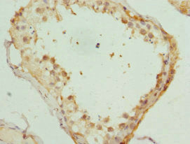 Immunohistochemistry of paraffin-embedded human testis tissue using KIF3A Antibody at dilution of 1:100