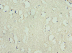Immunohistochemistry of paraffin-embedded human brain tissue using KIF3A Antibody at dilution of 1:100