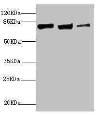 Western blot  | All lanes: KIF3A antibody at 9.45μg/ml  | Lane 1: MCF-7 whole cell lysate  | Lane 2: Rat gonad tissue  | Lane 3: 293T whole cell lysate  | Secondary  | Goat polyclonal to rabbit IgG at 1/10000 dilution  | Predicted band size: 80 kDa  | Observed band size: 80 kDa