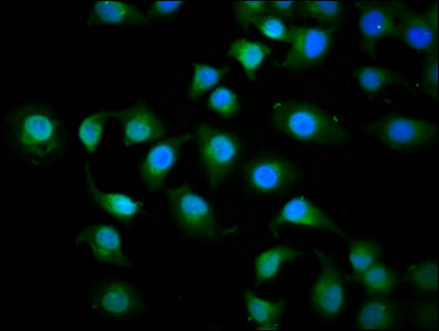Immunofluorescence staining of A549 cells with KIF3C Antibody at 1:200, counter-stained with DAPI. The cells were fixed in 4% formaldehyde, permeabilized using 0.2% Triton X-100 and blocked in 10% normal Goat Serum. The cells were then incubated with the antibody overnight at 4°C. The secondary antibody was Alexa Fluor 488-congugated AffiniPure Goat Anti-Rabbit IgG(H+L).