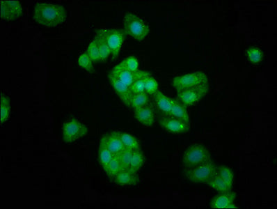 Immunofluorescence staining of HepG2 cells with KIFAP3 Antibody at 1:133, counter-stained with DAPI. The cells were fixed in 4% formaldehyde, permeabilized using 0.2% Triton X-100 and blocked in 10% normal Goat Serum. The cells were then incubated with the antibody overnight at 4°C. The secondary antibody was Alexa Fluor 488-congugated AffiniPure Goat Anti-Rabbit IgG(H+L).