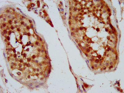 IHC image of the antibody diluted at 1:400 and staining in paraffin-embedded human testis tissue performed on a Leica BondTM system. After dewaxing and hydration, antigen retrieval was mediated by high pressure in a citrate buffer (pH 6.0). Section was blocked with 10% normal goat serum 30min at RT. Then primary antibody (1% BSA) was incubated at 4°C overnight. The primary is detected by a biotinylated secondary antibody and visualized using an HRP conjugated SP system.
