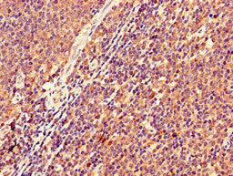 Immunohistochemistry of paraffin-embedded human lymph node tissue using the antibody at dilution of 1:100
