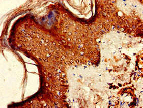 Immunohistochemistry of paraffin-embedded human skin tissue using KIR2DS2 Antibody at dilution of 1:100