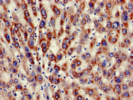 Immunohistochemistry of paraffin-embedded human liver tissue using KIR3DL1 Antibody at dilution of 1:100
