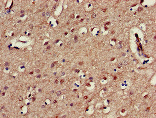 Immunohistochemistry of paraffin-embedded human brain tissue using KIR3DL1 Antibody at dilution of 1:100