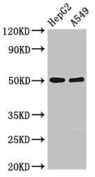 Western Blot | Positive WB detected in: HepG2 whole cell lysate, A549 whole cell lysate | All lanes: KIR3DL1 antibody at 2.5μg/ml | Secondary | Goat polyclonal to rabbit IgG at 1/50000 dilution | Predicted band size: 50, 39 kDa | Observed band size: 50 kDa