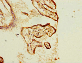 Immunohistochemistry of paraffin-embedded human placenta tissue using KLC1 Antibody at dilution of 1:100