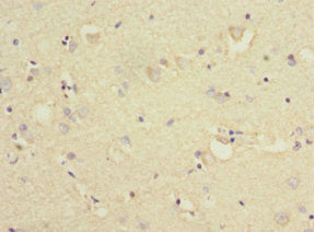 Immunohistochemistry of paraffin-embedded human brain tissue using KLC1 Antibody at dilution of 1:100