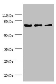 Western blot  | All lanes: KLC1 antibody at 1.34µg/ml  | Lane 1: Colo320 whole cell lysate  | Lane 2: HepG2 whole cell lysate  | Lane 3: SH-SY5Y whole cell lysate  | Secondary  | Goat polyclonal to rabbit IgG at 1/10000 dilution  | Predicted band size: 66, 64, 65, 72, 70, 67, 63, 73 kDa  | Observed band size: 72 kDa
