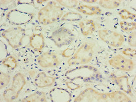 Immunohistochemistry of paraffin-embedded human kidney tissue using KLF3 Antibody at dilution of 1:100