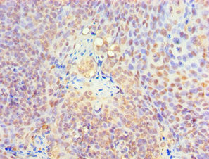 Immunohistochemistry of paraffin-embedded human tonsil tissue using KLF4 Antibody at dilution of 1:100Rabbit anti-Human KLF4 Polyclonal Antibody