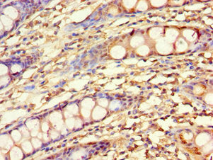 Immunohistochemistry of paraffin-embedded human colon tissue using KLF4 Antibody at dilution of 1:100Rabbit anti-Human KLF4 Polyclonal Antibody