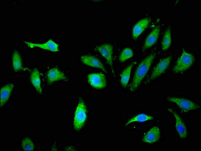 Immunofluorescent analysis of Hela cells using KLHL2 Antibody at dilution of 1:100 and Alexa Fluor 488-congugated AffiniPure Goat Anti-Rabbit IgG(H+L)
