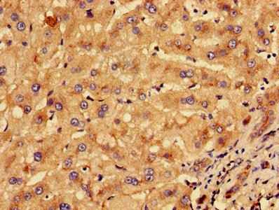 Immunohistochemistry of paraffin-embedded human liver tissue using KLHL2 Antibody at dilution of 1:100