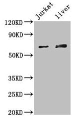 Western Blot  | Positive WB detected in: Jurkat whole cell lysate, Mouse liver tissue  | All lanes: KLHL2 antibody at 3µg/ml  | Secondary  | Goat polyclonal to rabbit IgG at 1/50000 dilution  | Predicted band size: 66, 67, 57 kDa  | Observed band size: 66, 67 kDa