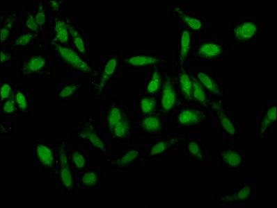 Immunofluorescence staining of Hela cells with KLK1 Antibody at 1:100, counter-stained with DAPI. The cells were fixed in 4% formaldehyde, permeabilized using 0.2% Triton X-100 and blocked in 10% normal Goat Serum. The cells were then incubated with the antibody overnight at 4°C. The secondary antibody was Alexa Fluor 488-congugated AffiniPure Goat Anti-Rabbit IgG(H+L).