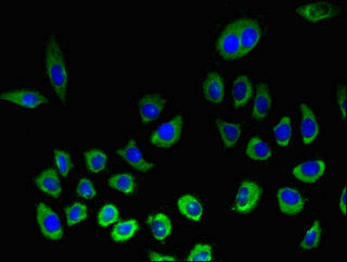 Immunofluorescent analysis of A549 cells using KLRK1 Antibody at dilution of 1:100 and Alexa Fluor 488-congugated AffiniPure Goat Anti-Rabbit IgG(H+L)Rabbit anti-Human KLRK1 Polyclonal Antibody