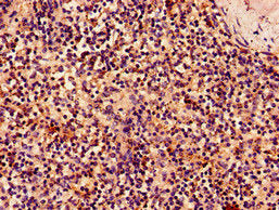 Immunohistochemistry of paraffin-embedded human spleen tissue using the antibody at dilution of 1:100Rabbit anti-Human KLRK1 Polyclonal Antibody