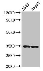 Western Blot  | Positive WB detected in: A549 whole cell lysate, HepG2 whole cell lysate  | All lanes: KLRK1 antibody at 3.7µg/ml  | Secondary  | Goat polyclonal to rabbit IgG at 1/50000 dilution  | Predicted band size: 26 kDa  | Observed band size: 34 kDaRabbit anti-Human KLRK1 Polyclonal Antibody