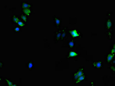 Immunofluorescent analysis of HepG2 cells using KPNA2 Antibody at dilution of 1:100 and Alexa Fluor 488-congugated AffiniPure Goat Anti-Rabbit IgG(H+L)
