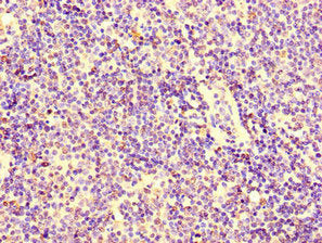 Immunohistochemistry of paraffin-embedded human lymph node tissue using the antibody at dilution of 1:100