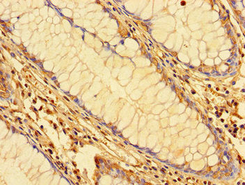 Immunohistochemistry of paraffin-embedded human colon tissue using KPNA2 Antibody at dilution of 1:100