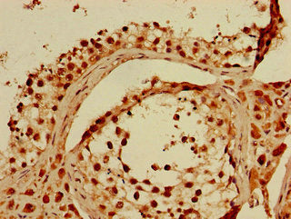 Immunohistochemistry of paraffin-embedded human testis tissue using KPNA4 Antibody at dilution of 1:100